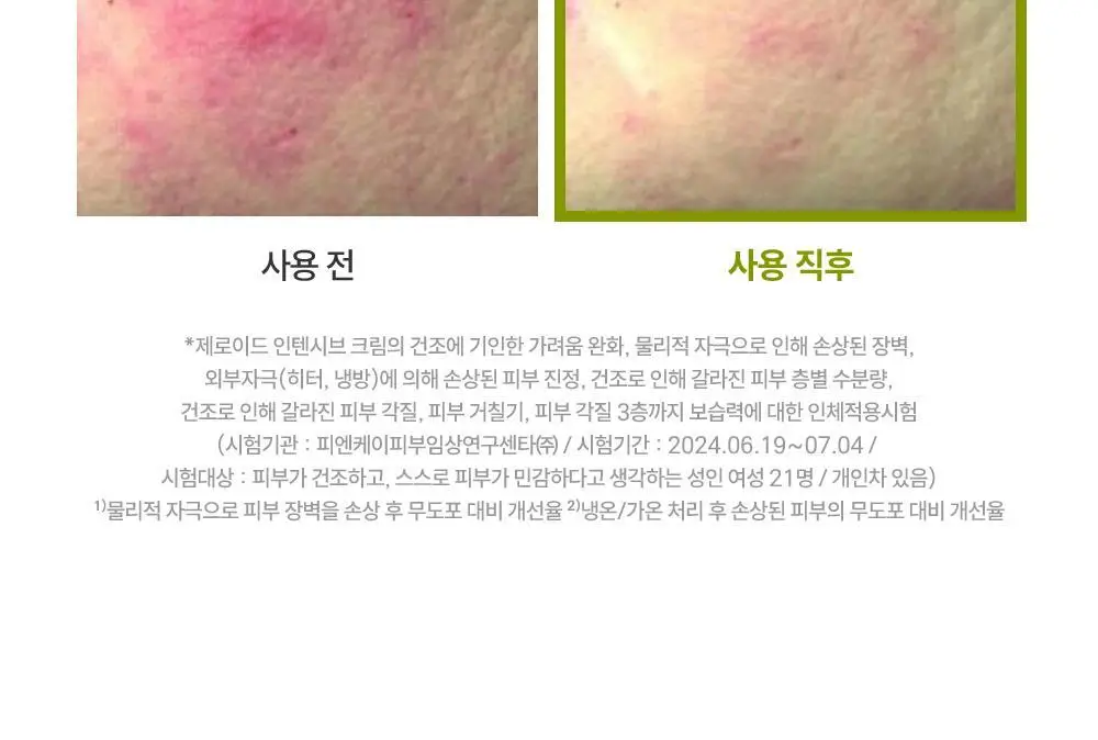 [대용량] 제로이드 인텐시브 크림 80ml 기획 (+50ml) 상세페이지 29